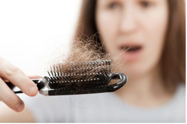 Nguyên nhân rụng tóc nhiều ở nữ và cách khắc phục : Vy Vy Hair Care Products