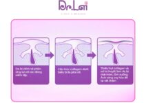 Tại sao vết thâm mụn lại khó điều trị và dễ quay lại?